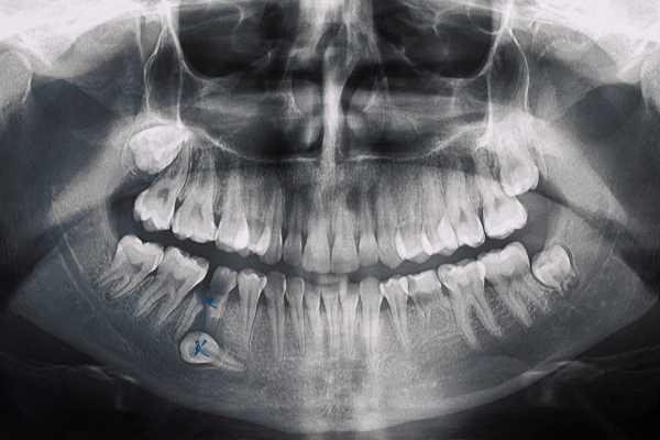 O Que é Necessário Para Abrir Uma Clínica de Radiologia Odontológica em 2024